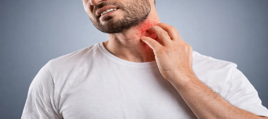Homem branco com erupção vermelha e coceira no pescoço.